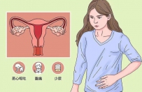 卵巢过度刺激综合征在促排期有哪些症状？应该如何应对？