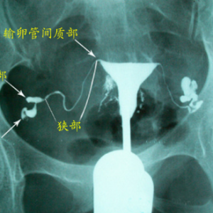 什么时候做妇科b超检查最好?