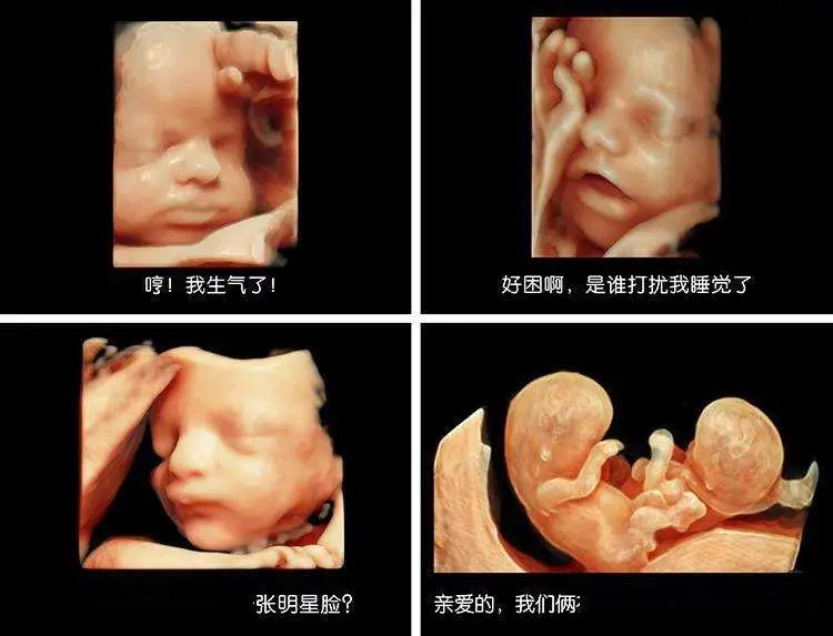 早孕有哪些反应,如何应对?