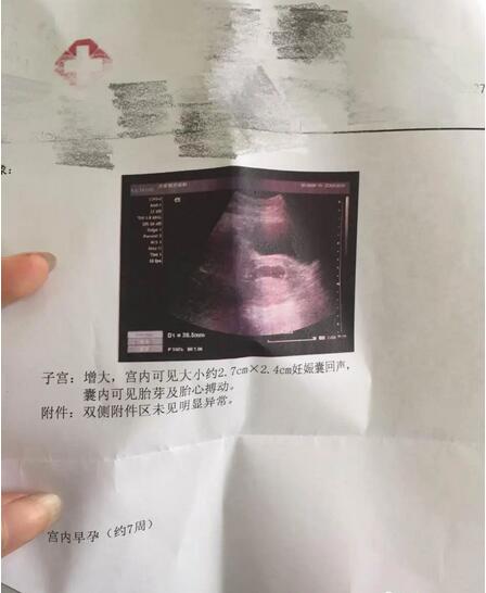 西安供卵公司