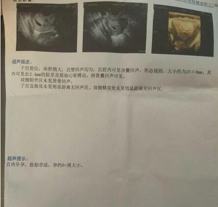 西安供卵公司