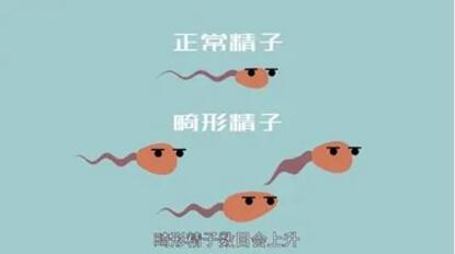 男性精子畸形率98%影响受孕吗?附如何治疗附睾结核引起的畸形精子症!