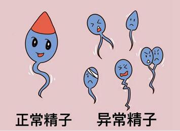导致精子畸形的原因是什么?预防畸形精子症最有效的方法!