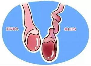 睾丸有点胀痛是什么原因?五个原因要重视!