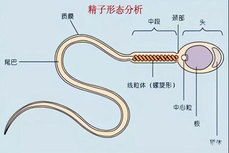 畸形精子症是不是可以做试管?精子畸形可以做二代试管吗?