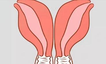 子宫畸形能不能生小孩?先天性子宫畸形如何做试管婴儿?