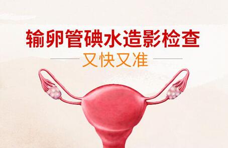 输卵管造影和输卵管通液哪个更好?