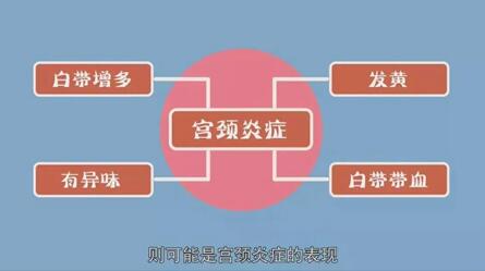 重度宫颈炎好治疗吗?各类型宫颈炎最佳治疗方法!