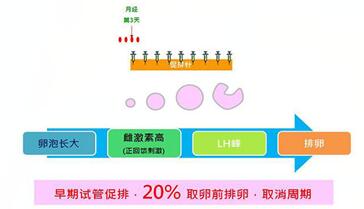 多囊卵巢做试管适合什么方案促排卵?