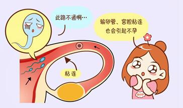 女性输卵管哪些疾病都是导致不孕的?输卵管不孕症的原因!