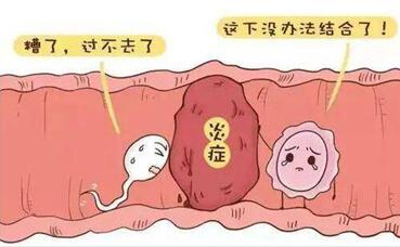 多囊卵巢为什么要多次促排才能成功怀上孩子?