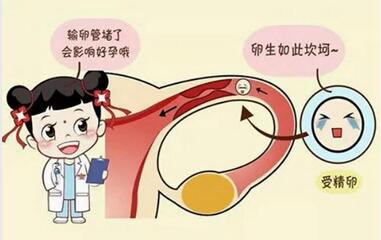 输卵管疏通术的费用是多少?女性输卵管不通怎么疏通好?