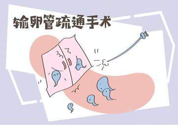 输卵管疏通手术价格明细曝光,堵塞程度不同所需费用不一!