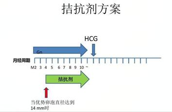 什么是拮抗剂方案?适不适合自己看完就知道答案!