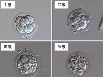 石家庄供卵公司