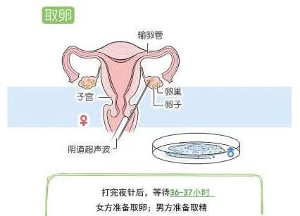 什么时间取卵最佳?多久可以取卵因人而异!
