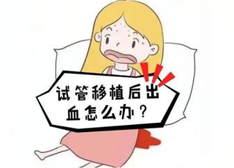 试管婴儿移植后出血如何处理?这些保胎成功的经验要牢记在心!