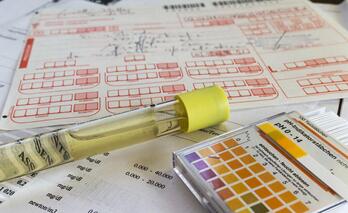 试管尿常规查的是什么?试管尿常规不合格怎么办?