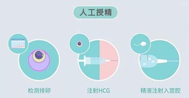 人工授精成功率有多少?人工授精十个有九个不成功吗