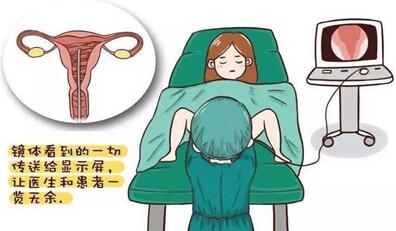 宫腔分离一般多久会好?宫腔分离会引起哪些疾病
