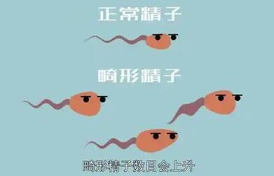 畸形率97%正常精子3%也还有的救,精子畸形率是多少正常?