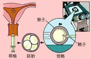 体外胚胎培养收两次费用合不合理?看完就清楚了