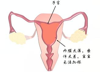 prp治疗子宫内膜薄效果怎样?prp宫腔灌注治疗内膜薄有用吗