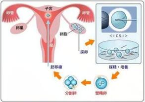 取卵后体外胚胎培养为什么不成功?胚胎培养失败的原因