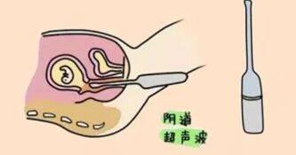 试管移植后可以做阴超吗?移植后做阴超会不会有影响