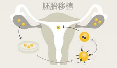 试管移植反复着床失败可以打瑞白吗?瑞白对胚胎有什么作用