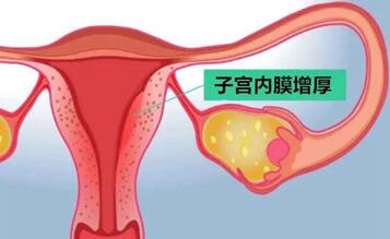 怀孕时子宫内膜厚度,怀孕子宫内膜厚正常范围内是多少?