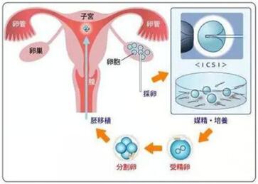试管婴儿取卵后受精率低的原因