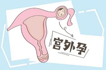 做完宫外孕手术后多久会来月经?宫外孕术后注意事项