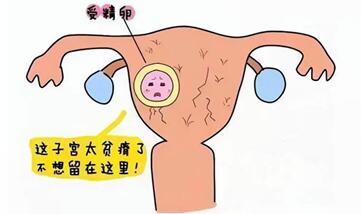 子宫内膜不均匀是什么意思?子宫内膜凹凸不平是怎么回事