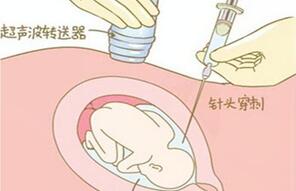 石家庄供卵公司