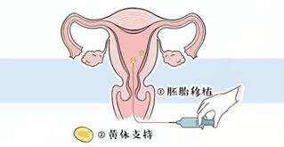 试管婴儿需要一直打黄体酮吗?黄体酮对试管起什么作用