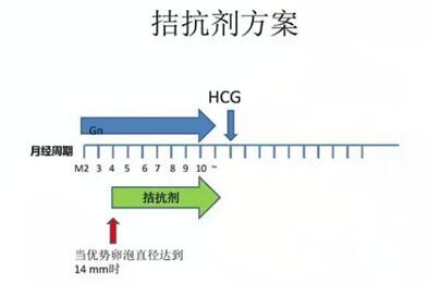 抗拮抗剂方案怎么选择最佳?试管拮抗剂方案成功率高吗