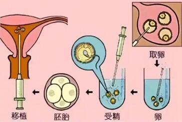 试管婴儿取卵后精子卵子不结合的原因,先弄清楚原因才是关键