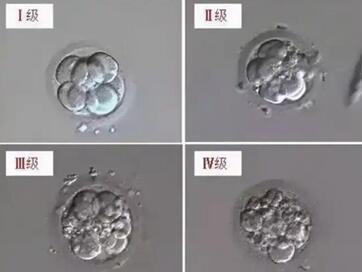 试管都有哪几种胚胎形态?单核多核胚胎的优势与劣势